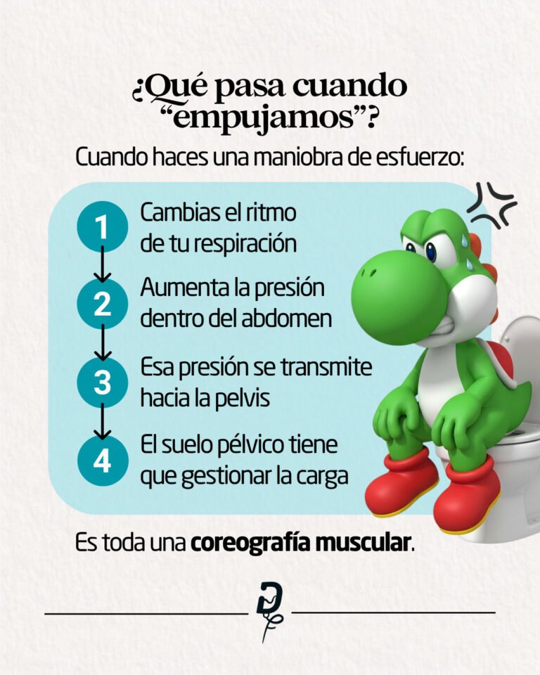 Estreñimiento crónico: por qué te pasa y qué ayuda de verdad 3 Lámina del Dr. Fontanals sobre qué pasa al empujar en el estreñimiento crónico: la presión del abdomen llega a la pelvis